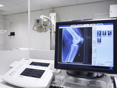 Röntgenuntersuchung Kniegelenk