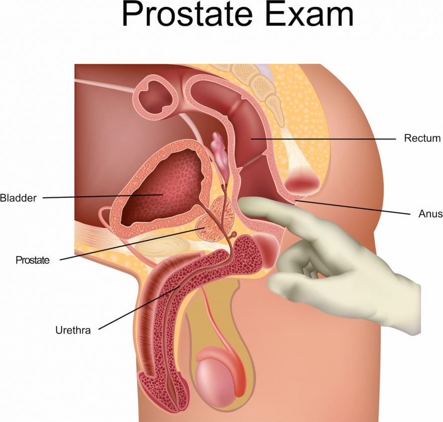 Prostata selbst tasten