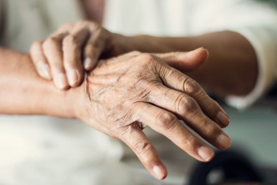 Ältere Frau mit Arthritis